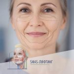 SMAS-лифтинг: Раскрываем Секрет Вечной Молодости и Безупречных Контуров Лица и Тела